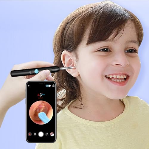 Black Wireless Ear Otoscope with Camera and 8 Pcs Ear Set T2626