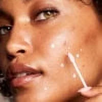 Acne Treatment 1 fl oz I466